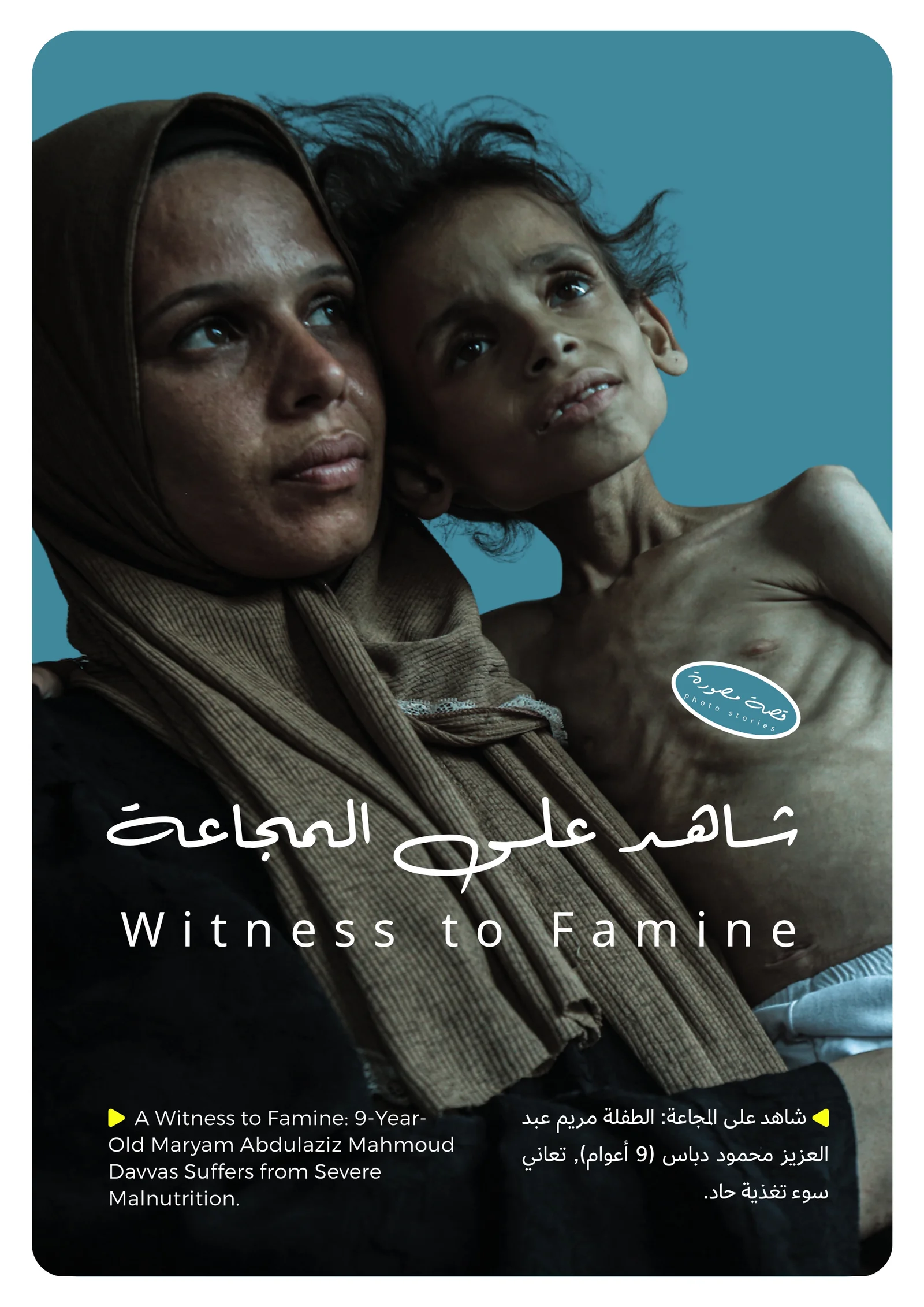 شاهد على المجاعة